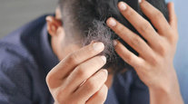 What do with hair loss from stress?