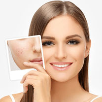 acnetreatmentindubai